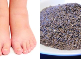 როგორ შევაჩეროთ ფეხების შეშუპება?