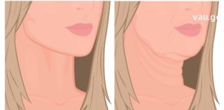 ყელზე ჩამოწელილი კანი ამ ნიღბით დავიჭიმე. გირჩევთ თქვენც სცადოთ.