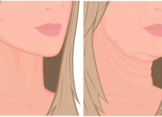 ყელზე ჩამოწელილი კანი ამ ნიღბით დავიჭიმე. გირჩევთ თქვენც სცადოთ.