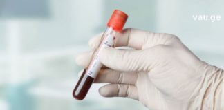 როგორ უნდა აიმაღლოთ ჰემოგლობინი სახლის პირობებში?