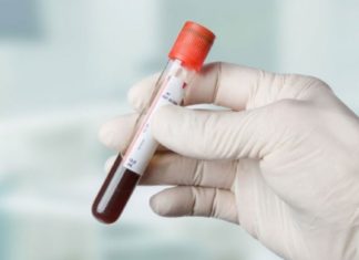 როგორ უნდა აიმაღლოთ ჰემოგლობინი სახლის პირობებში?