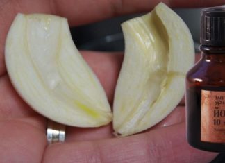 ნიორი და იოდი: სასწაულმოქმედი რეცეპტი პირდაპირ მოხუცი ექთნის ბლოკნოტიდან.