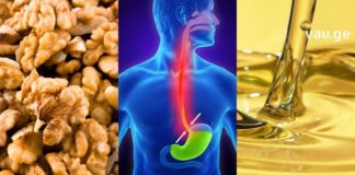 ჩემ მეუღლეს ყოველდღე იჟოგა ტანჯავდა სანამ ეს რეცეფტები არ სცადა