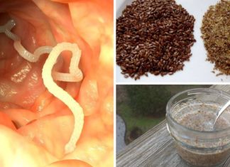 სელის თესლისა და მიხაკის დახმარებით გაათავისუფლეთ ორგანიზმი მიკრობებისა და პარაზიტებისგან