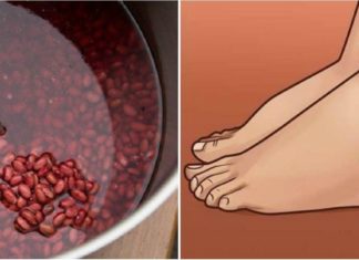 ლობიოს ნახარში შეშუპების სამკურნალოდ. ის, რაც აქამდე არ იცოდით