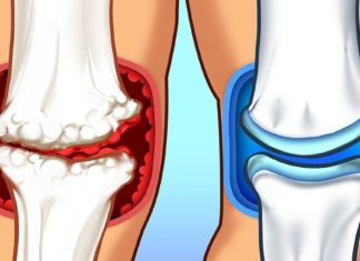 ამ მეთოდით გიცდიათ ძვლების და სახსრების მორჩენა?