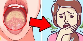 პირის ღრუდან უსიამოვნო სუნი დიდი დისკომფორტია. სცადეთ ეს მეთოდები