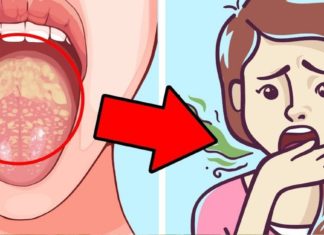 პირის ღრუდან უსიამოვნო სუნი დიდი დისკომფორტია. სცადეთ ეს მეთოდები