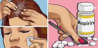 ასპირინის გამოყენების 7 გზა, რომელიც ყველა ქალმა უნდა იცოდეს!