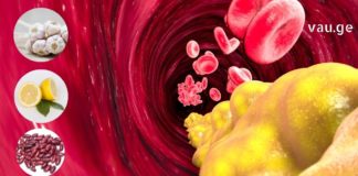 ბებიების რეცეფტი ქოლესტერინის დასაწევად.