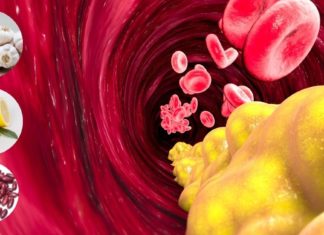 ბებიების რეცეფტი ქოლესტერინის დასაწევად.