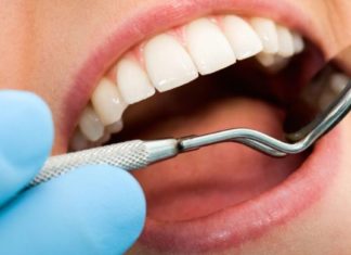 იცოდით რომ ეს პროდუქტები კბილებს აზიანებს?