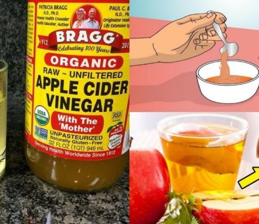 10 მიზეზი იმისა, თუ რატომ უნდა დალიოთ დაძინებამდე ვაშლის ძმარი!