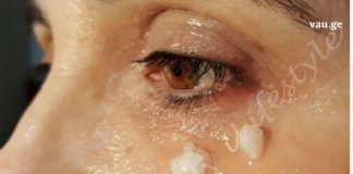 Რა ხდება 5 წუთის შემდეგ, რაც ქოქოსის ზეთს წაისვამთ თვალების გარშემო? თქვენ გაგაოცებთ შედეგი !