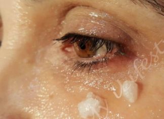 Რა ხდება 5 წუთის შემდეგ, რაც ქოქოსის ზეთს წაისვამთ თვალების გარშემო? თქვენ გაგაოცებთ შედეგი !