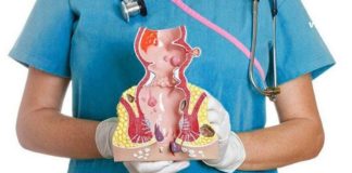 ბუასილის ყველაზე ეფექტური სამკურნალო რეცეფტები