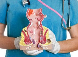 ბუასილის ყველაზე ეფექტური სამკურნალო რეცეფტები