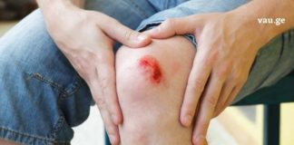 როგორ შევაჩეროთ ჭრილობიდან სისხლდება 10 წამში