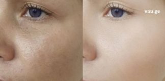 ფიჭვის კრემი ეფექტურია განსაკუთრებით ორმოცდაათ წელს გადაცილებური ქალებისთვის. კანის ელასტიურობა 25% -ით იზრდება და 8% -ით ტენიანდება.