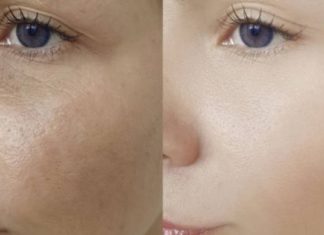 ფიჭვის კრემი ეფექტურია განსაკუთრებით ორმოცდაათ წელს გადაცილებური ქალებისთვის. კანის ელასტიურობა 25% -ით იზრდება და 8% -ით ტენიანდება.