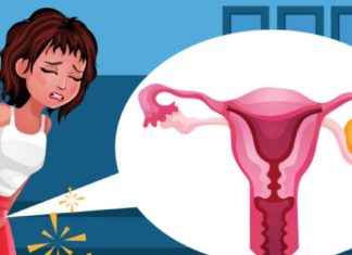 მიომას მკურნალობა ხალხური საშუალებებით