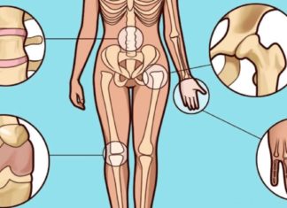 მე ეს შევძელი! თქვენც გამოგივათ. დაამარცხეთ სამუდამოდ მტანჯველი ართრიტი