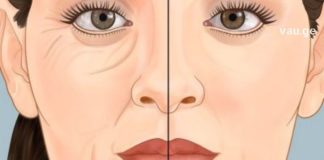 ნაოჭების გაქრობა ამ მეთოდით ყველაზე მარტივი და ეფექტურია. სცადეთ!