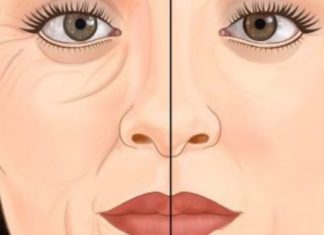 ნაოჭების გაქრობა ამ მეთოდით ყველაზე მარტივი და ეფექტურია. სცადეთ!