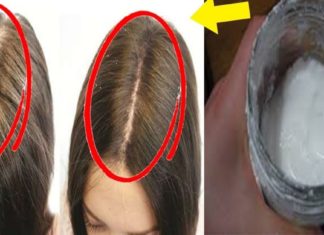 საჭმელი სოდისგან შამპუნის მომზადება დავიწყე და ჩემი თმა ელვის სისწრაფით იზრდება. აი რეცეპტიც!