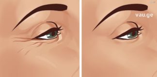 როგორ მოვიქცეთ რომ თვალების გარშემო ნაოჭები მოვიცილოთ? ეს შესაძლებელია იაფი მეთოდებით სახლში