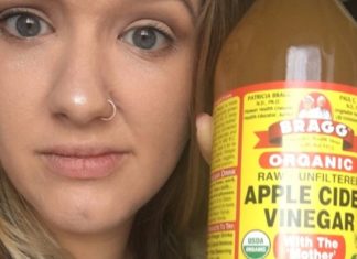 5 შემთხვევა როდესაც არ უნდა გამოიყენოთ ვაშლის ძმარი.