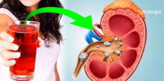 ფილტვებისა და ბრონქების გაწმენდა ხალხური მედიცინის დახმარებით ყველაზე მარტივია