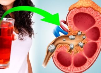 ფილტვებისა და ბრონქების გაწმენდა ხალხური მედიცინის დახმარებით ყველაზე მარტივია