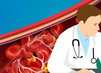 კარდიოლოგის მიერ დასახელებული 6 საკვები, რომელიც სისხლს ათხელებს