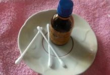 ნახეთ როდის არის საჭირო იოდის ბადეების გაკეთება