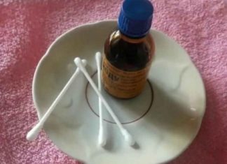 ნახეთ როდის არის საჭირო იოდის ბადეების გაკეთება