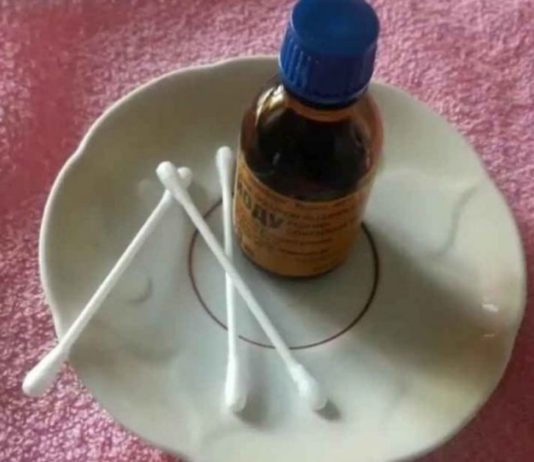 ნახეთ როდის არის საჭირო იოდის ბადეების გაკეთება