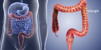 ნაწლავების წმენდა ამ მეთოდით ყველაზე ეფექტურია