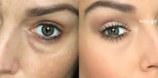 შეშუპებული და ჩაშავებული კანი თვალების ირგვლივ შეგიძლიათ ამ მარტივი ინგრედიენტების გამოყენებით სამუდამოდ დაივიწყოთ