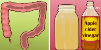 გთავაზობთ ნაწლავის ნატურალური გასუფთავების რეცეპტს თაფლისა და ვაშლის ძმრის გამოყენებით.