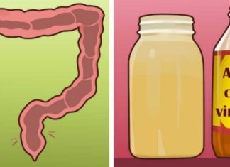 გთავაზობთ ნაწლავის ნატურალური გასუფთავების რეცეპტს თაფლისა და ვაშლის ძმრის გამოყენებით.