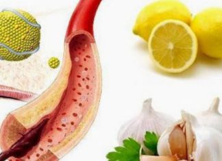 ამ ნარევით სისხლძარღვების გასუფთავება ყოფილა ყველაზე სწრაფი და უსაფრთხო