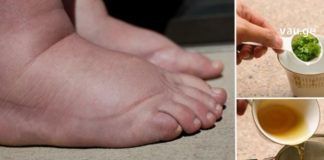 ნახეთ როგორ უნდა დაამარცხოთ შეშუპება მარტივი გზით