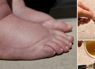 ნახეთ როგორ უნდა დაამარცხოთ შეშუპება მარტივი გზით