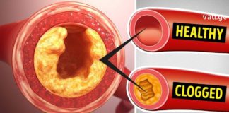 Ნუ დახარჯავთ ზედმეტ ფულს წამლებში ქოლესტერინისა და სისხლის წნევის კონტროლისთვის – შეეცადეთ გამოიყენოთ ეს საშუალება 7 დღის განმავლობაში!