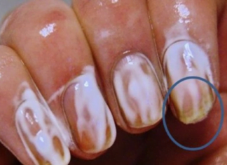 აი, რა ეფექტი ექნება სოდას თუ ფრჩხილებზე წაისვამთ. ამის შემდეგ ასე ხშირად მოიქცევით