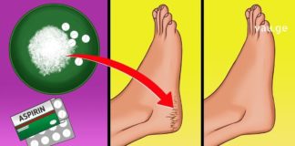 ეს წამალი დახეთქილი ქუსლების პრობლემას მხოლოდ 10 დღეში მოგაშორებთ