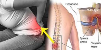 როგორ ვუმკურნალოთ მალთაშუა თიაქარს ოპერაციის გარეშე: ეფექტური მეთოდი!