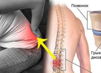 როგორ ვუმკურნალოთ მალთაშუა თიაქარს ოპერაციის გარეშე: ეფექტური მეთოდი!