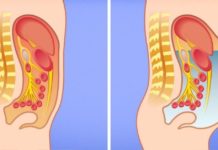 როდის არის ღვიძლი საფრთხის წინაშე? როგორ უნდა მივხდეთ, რომ ღვიძლს ყურადღება სჭირდება?